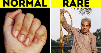 If You Wondered Why Your Body Does That, Now You Know
