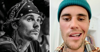 What Happened to Justin Bieber: Update After His Facial Paralysis Diagnosis