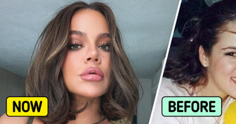 “None of It Works” – Celebs Speak Out on Plastic Surgery