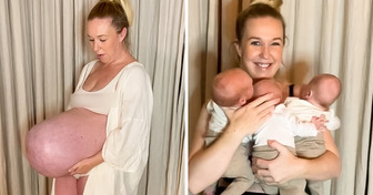 Mom Opens Up About Her Pregnancy With a Huge Baby Bump: “I Was Massive, Hurting So Bad”